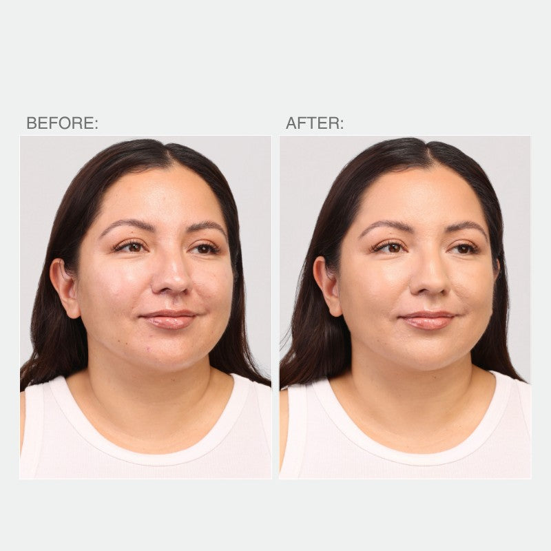 Woman's face, before and after Spot Treat Concealer — BEFORE: AFTER: