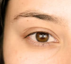 Before Image of Brow Transformation