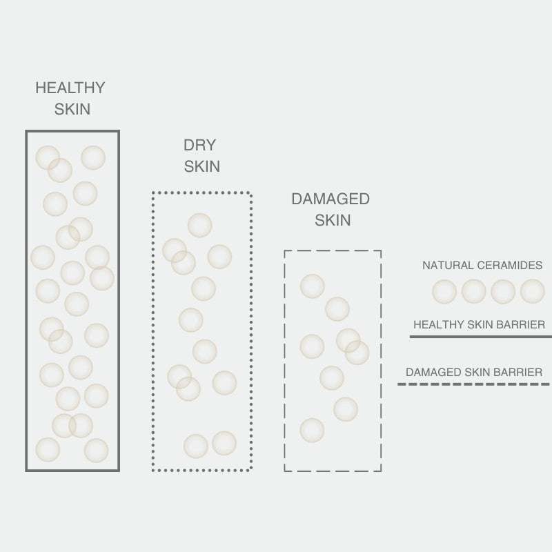HEALTHY SKIN, DRY SKIN, DAMAGED SKIN: columns of ceramide dots; NATURAL CERAMIDES, HEALTHY SKIN BARRIER, DAMAGED SKIN BARRIER labeled.