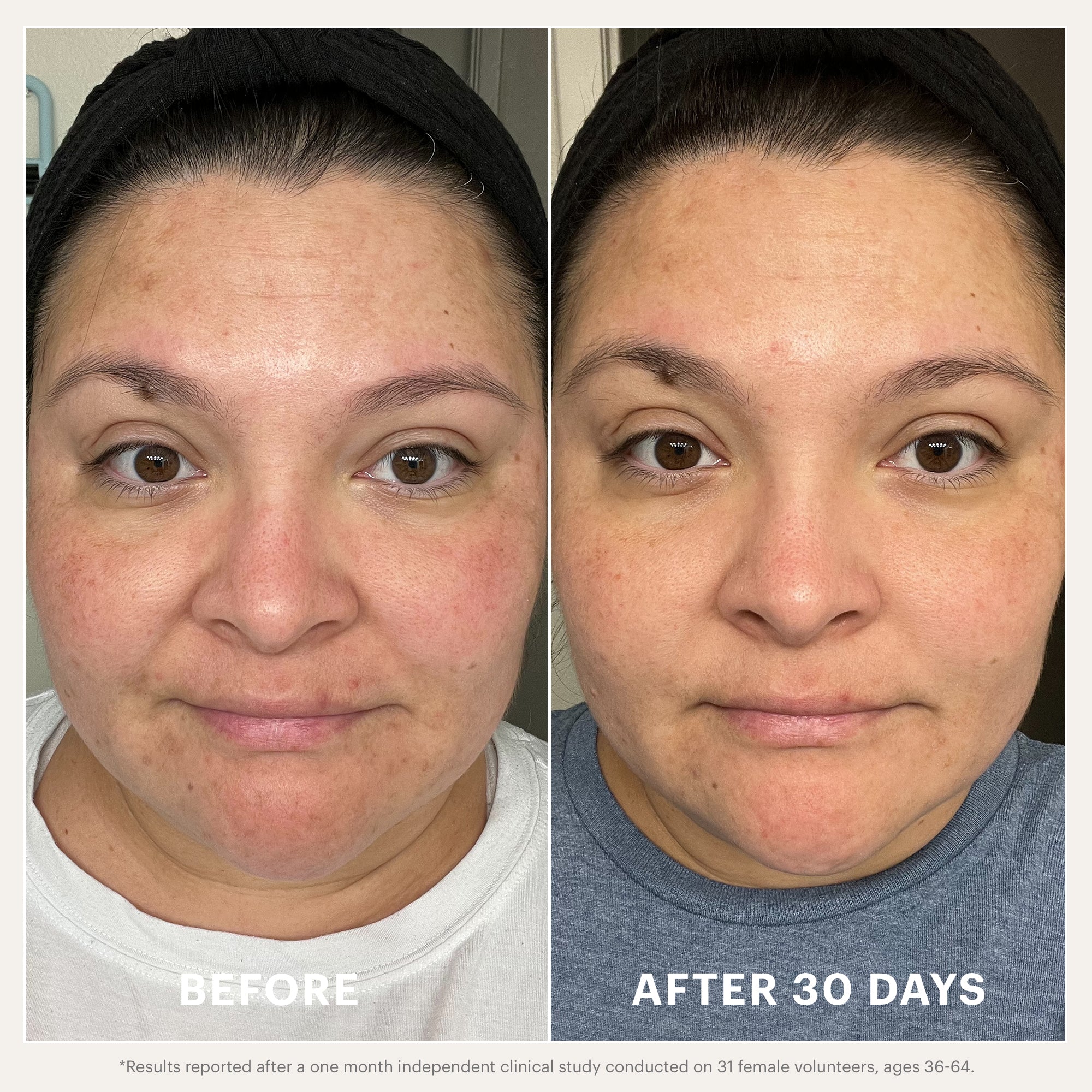 Renew Serum