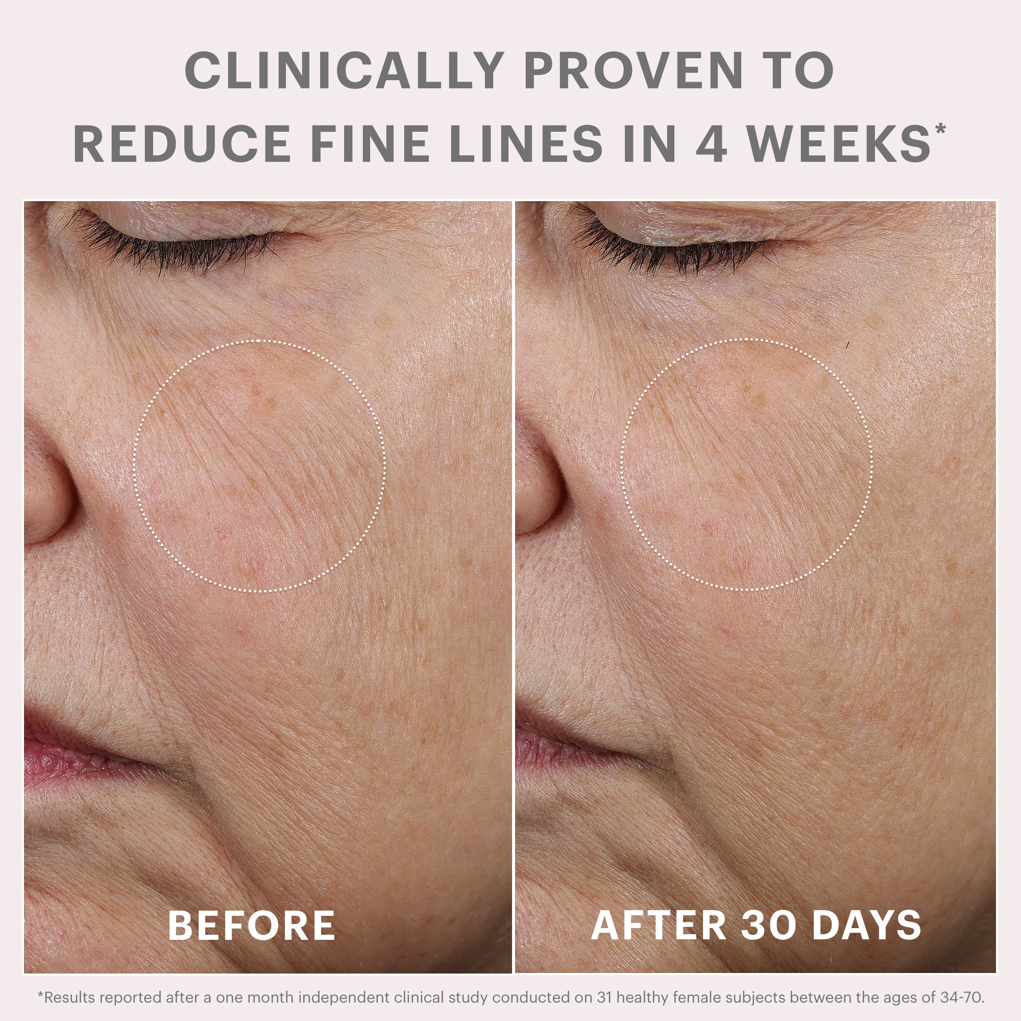 Before-and-after comparison showing clinically proven reduction of fine lines in 4 weeks